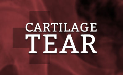 Cartilage Tear Doctor